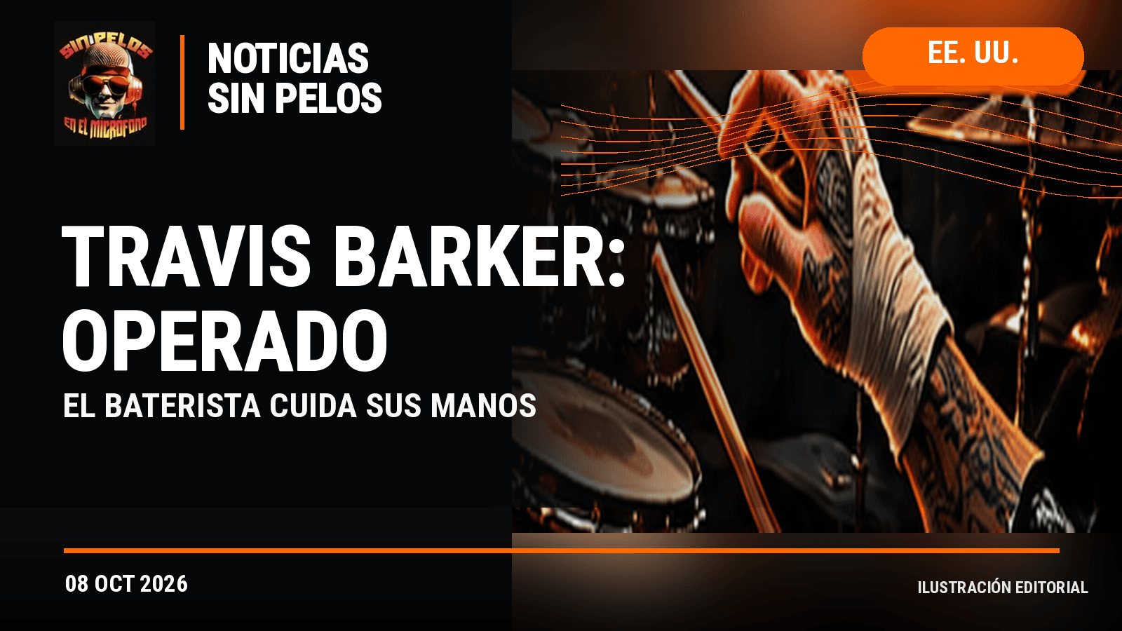 TRAVIS BARKER PASA POR CIRUGÍA PARA PROTEGER SUS MANOS Y PODER SEGUIR TOCANDO